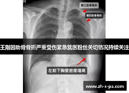 王刚因肋骨骨折严重受伤紧急就医粉丝关切情况持续关注 王刚因肋骨骨折严重受伤紧急就医粉丝关切情况持续关注